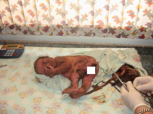VƏHŞİLİK! Yeni doğulmuş körpəni 14 yerindən bıçaqlayıb diri-diri basdırdılar (+18 FOTOLAR)
