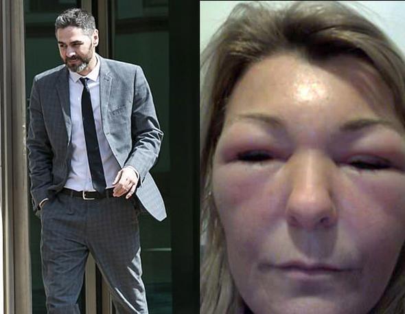 Bütün ölkə bu həkimdən danışır - Botoks etdiyi qadınlar tanınmaz haldadır - FOTOLAR