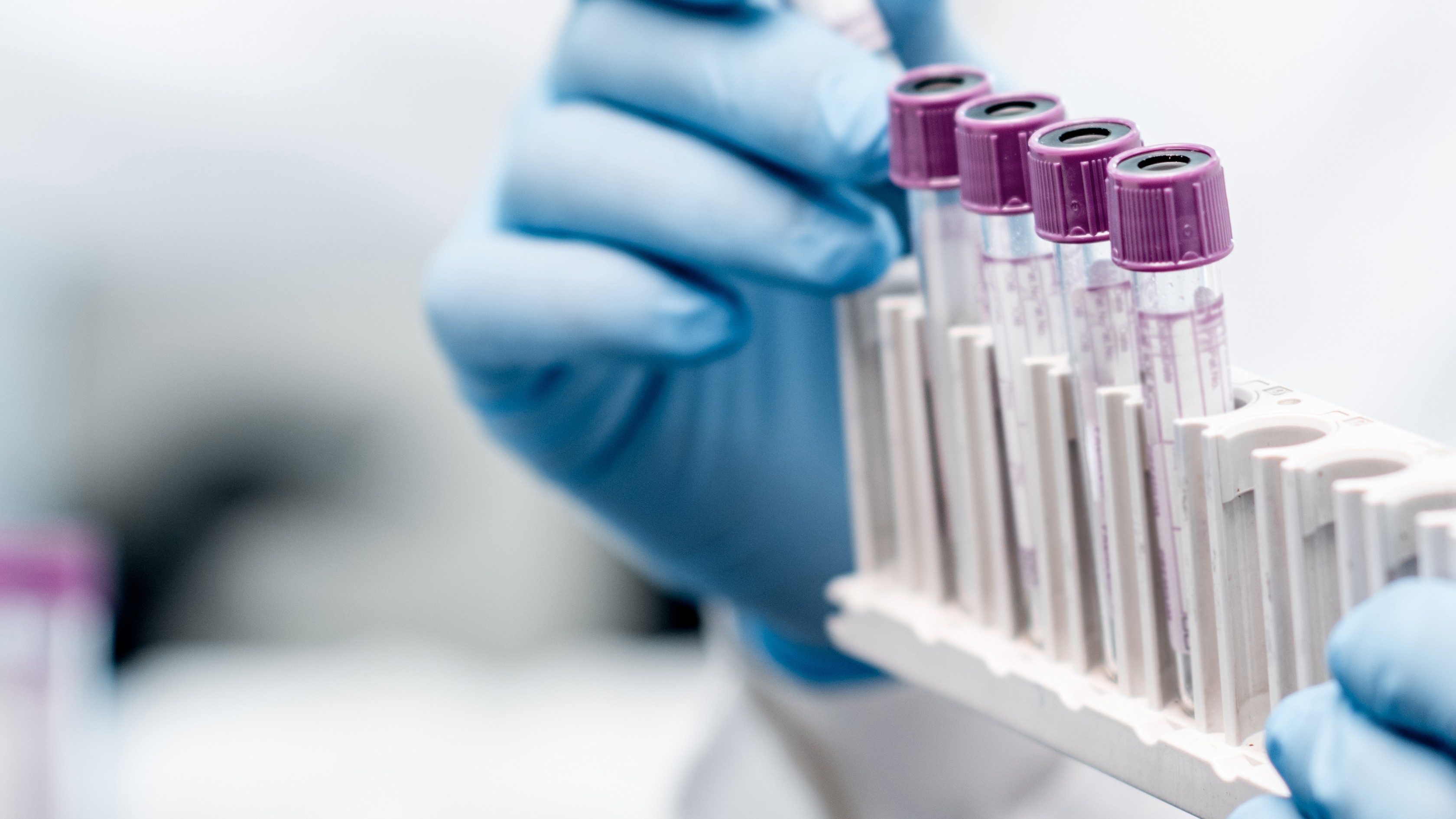 Bu laborator analizləri pulsuz verə bilərik - SİYAHI