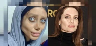 \"Həyatımda heç vaxt plastik əməliyyat etdirməmişəm\" - <span style=\"color: #ff0000;\">Ancelina Coliyə bənzəmək istəyən qadın</span>