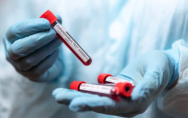 Azərbaycanda son bir həftənin koronavirus<span style=\"color: #ff0000;\"> STATİSTİKASI</span><span style=\"color: #ea094b;\"></span>