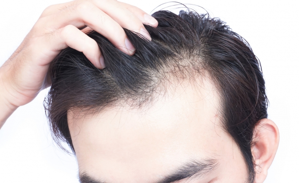 Bu sabun yağlı saçlar üçün ən ideal vasitədir - FOTO