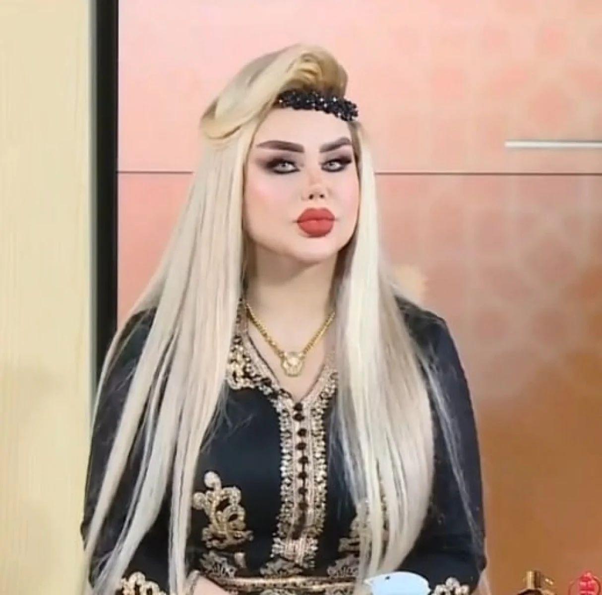 “Barbi”yə oxşamaq üçün 43 plastik əməliyyat etdirdi - FOTOLAR