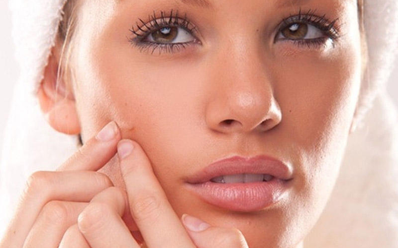 Bu qidalar üzdə sızanaq yaradır – Dermatoloqlardan XƏBƏRDARLIQ