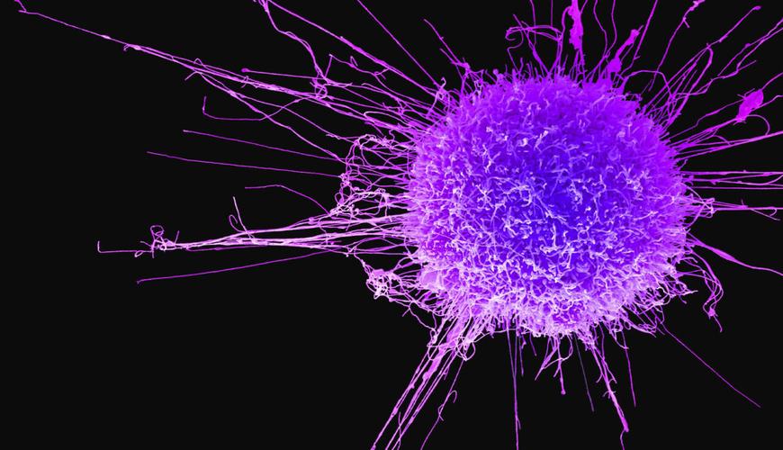 Bu qablar xərçəng yaradır - XƏBƏRDARLIQ