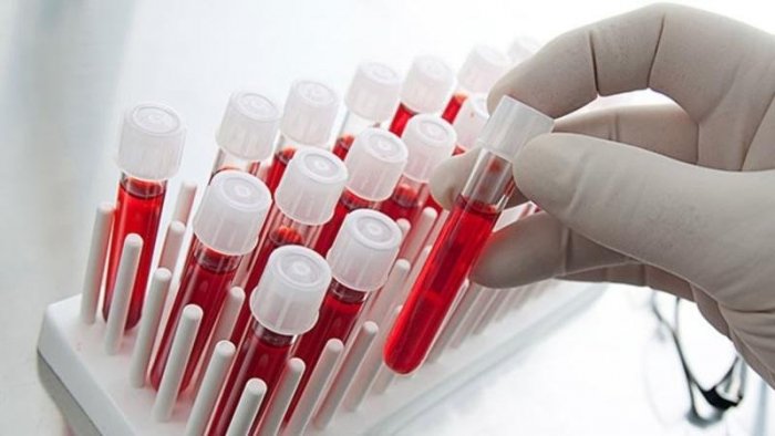 Yeni qan qrupu kəşf edildi