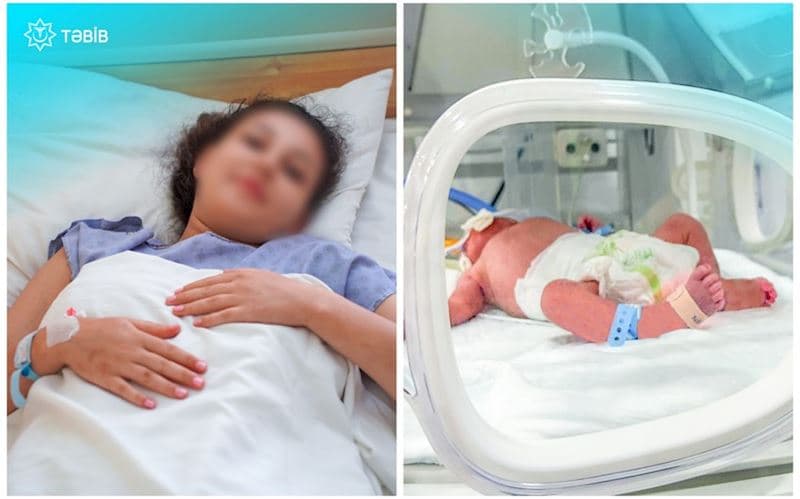 Metroda doğulan körpə CPAP cihazına qoşulub - <span style="color:#ff0000">Vəziyyəti qənaətbəxş deyil</span>