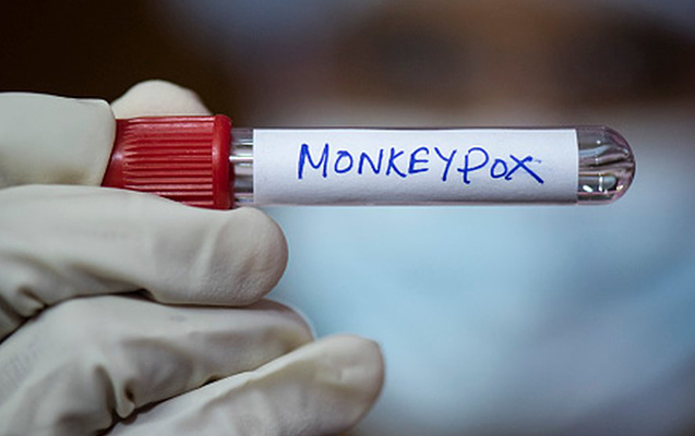 ÜST-dən meymunçiçəyi ilə bağlı - XƏBƏRDARLIQ