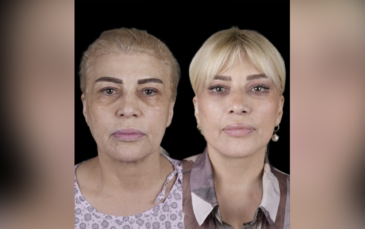 Mətanət İsgəndərlinin bu görüntüləri izləyiciləri təəccübləndirdi - FOTO