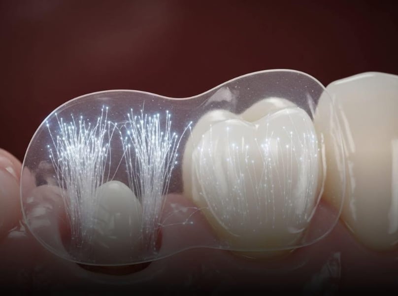 Dişlərlə bağlı mühüm yenilik – Protezlərə son qoyula bilər - FOTO