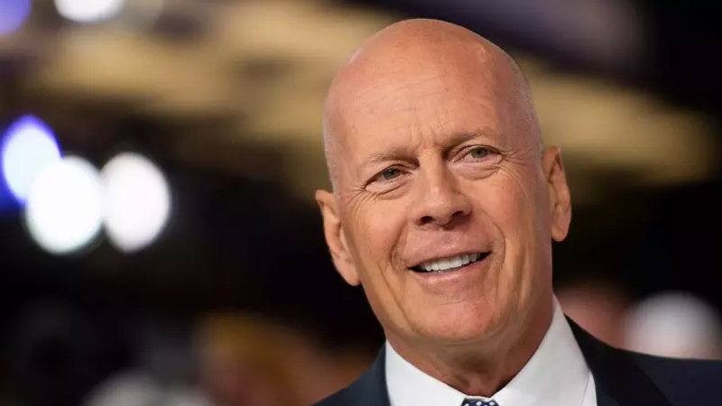 Məşhur aktyorun beyni bağışlanacaq - Həyat yoldaşı qərar verdi