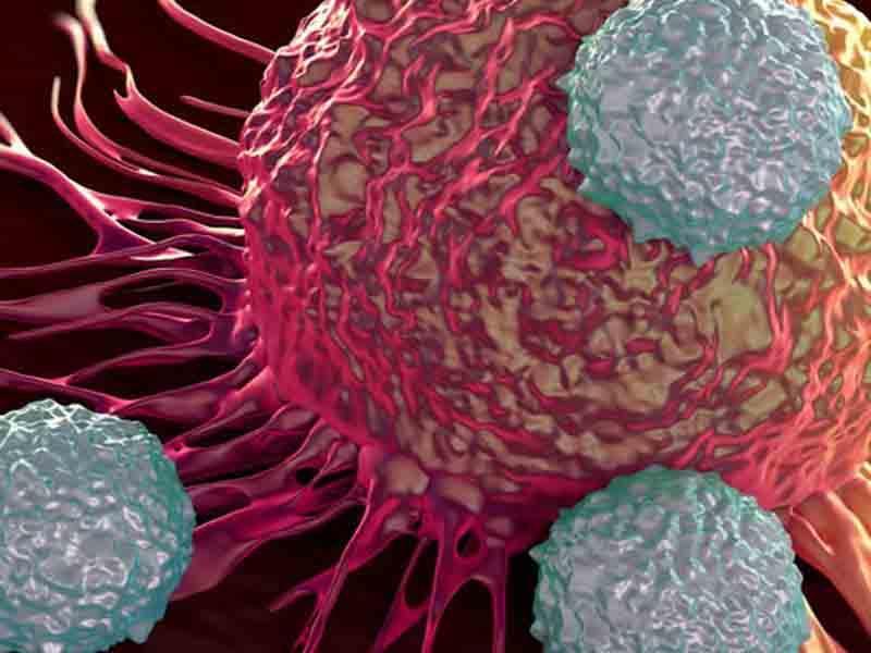 Xərçəng riskini azaldan sadə vərdişlər – Həkimdən vacib açıqlama