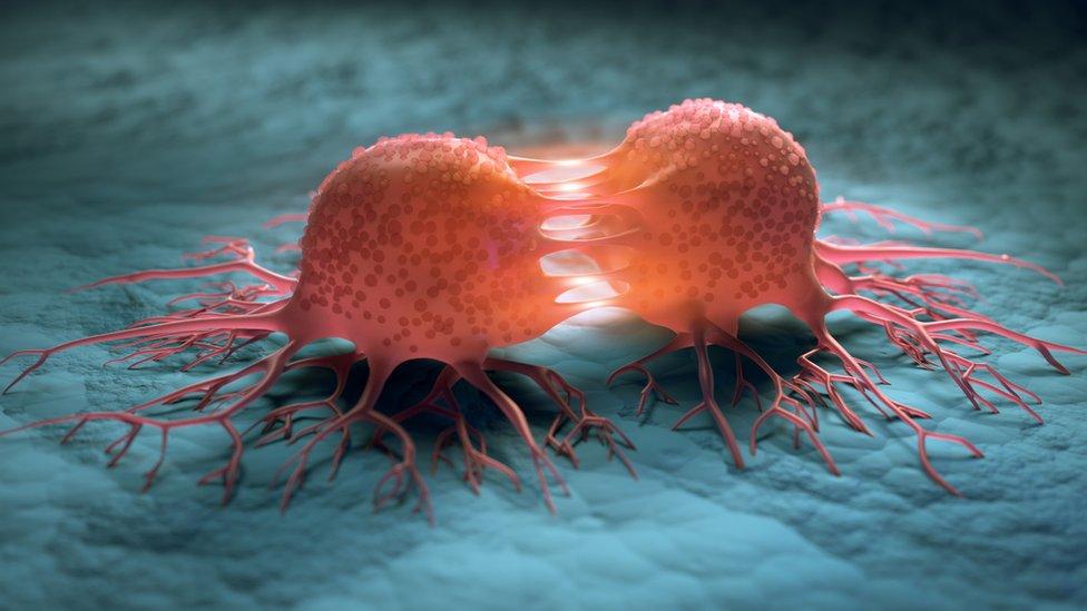 Bu, xərçəng hüceyrələrini məhv edəcək - YENİLİK