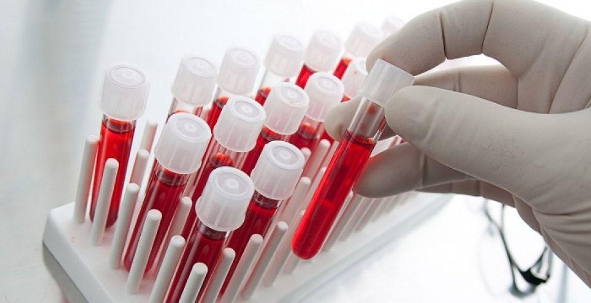 Mədəaltı vəzi xərçəngində ümidverici irəliləyiş