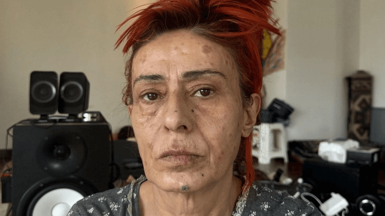 Xəstəxanaya yerləşdirilən Yıldız Tilbedən AÇIQLAMA