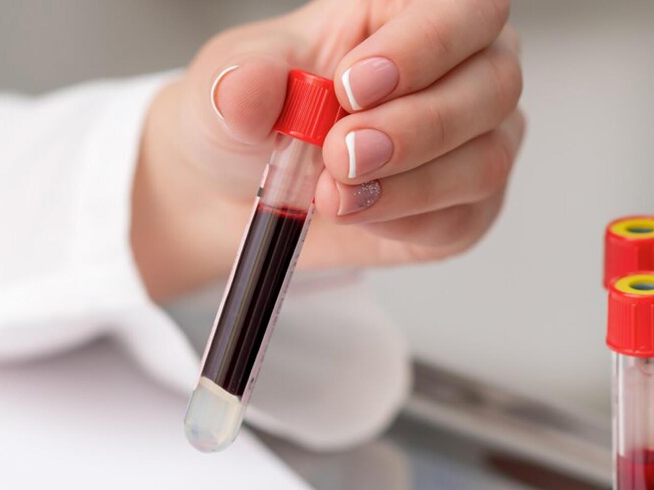 Bu qan qrupuna sahib insanlar çox yaşayır