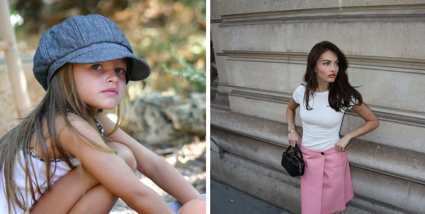 "Dünyanın ən gözəl qızı" tanınmaz dərəcədə dəyişib - Fotolar