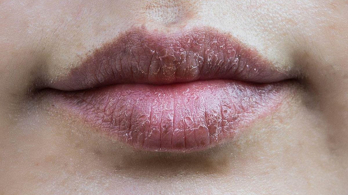 Psixologiyaya görə dodaqları çeynəmək vərdişi nə deməkdir?