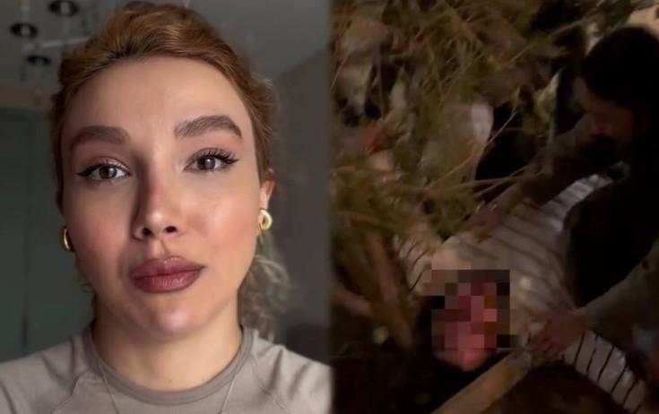 Aktrisa Bakıda getdikləri restoranda dostunun döyüldüyünü dedi -Video