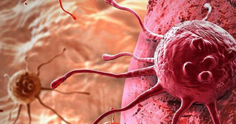 Məşhur modeldən üzücü xəbər