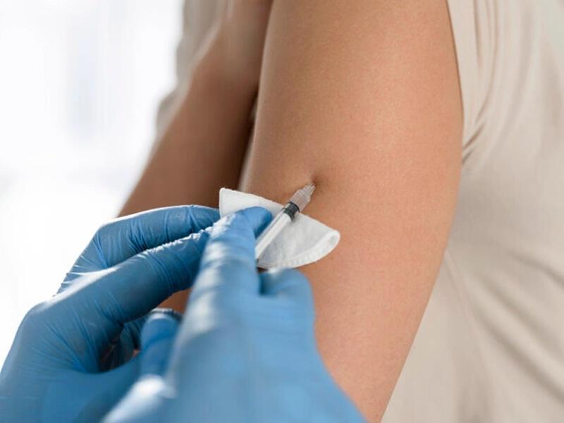 Azərbaycanda bu şəxlər peyvənd OLUNACAQ - RƏSMİ