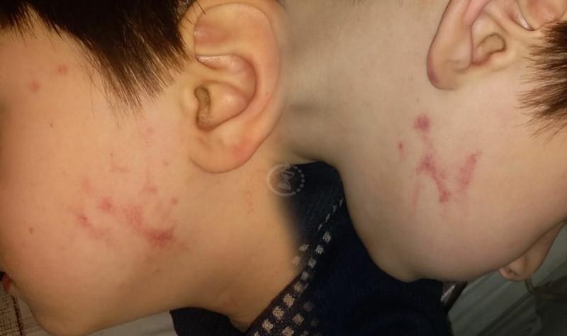 Bağçada zorakılıq iddiası araşdırılır