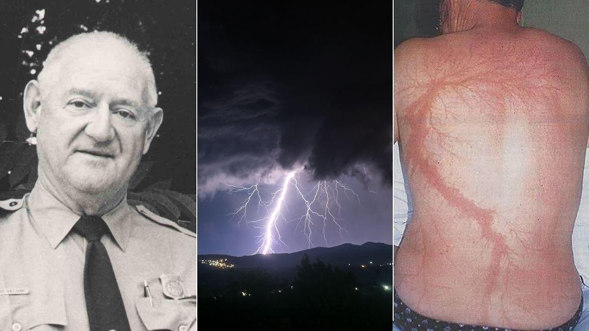 35 ildə dəfələrlə ildırım çarpıb - FOTOLAR