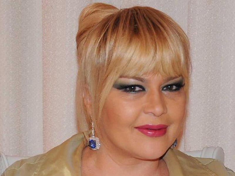 Əməkdar artist üz gərmə əməliyyatından sonra BELƏ OLDU - VİDEO