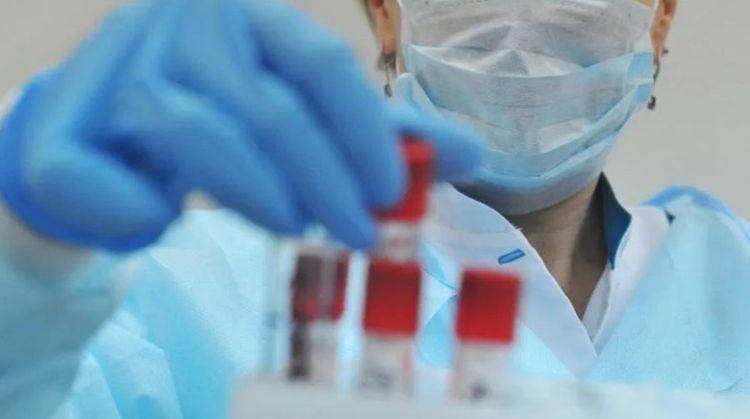 Dünyada koronavirusa yoluxanların sayı 474 mini keçib, 21 min nəfər ölüb Dünyada koronavirusa yoluxanların sayı 474 mini keçib, 21 min nəfər ölüb