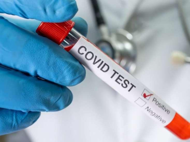 Bu müəssisələrə giriş zamanı COVID-19 testi tələbi ləğv edilir Bu müəssisələrə giriş zamanı COVID-19 testi tələbi ləğv edilir