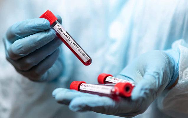 Azərbaycanda son bir həftənin koronavirus STATİSTİKASI Azərbaycanda son bir həftənin koronavirus STATİSTİKASI