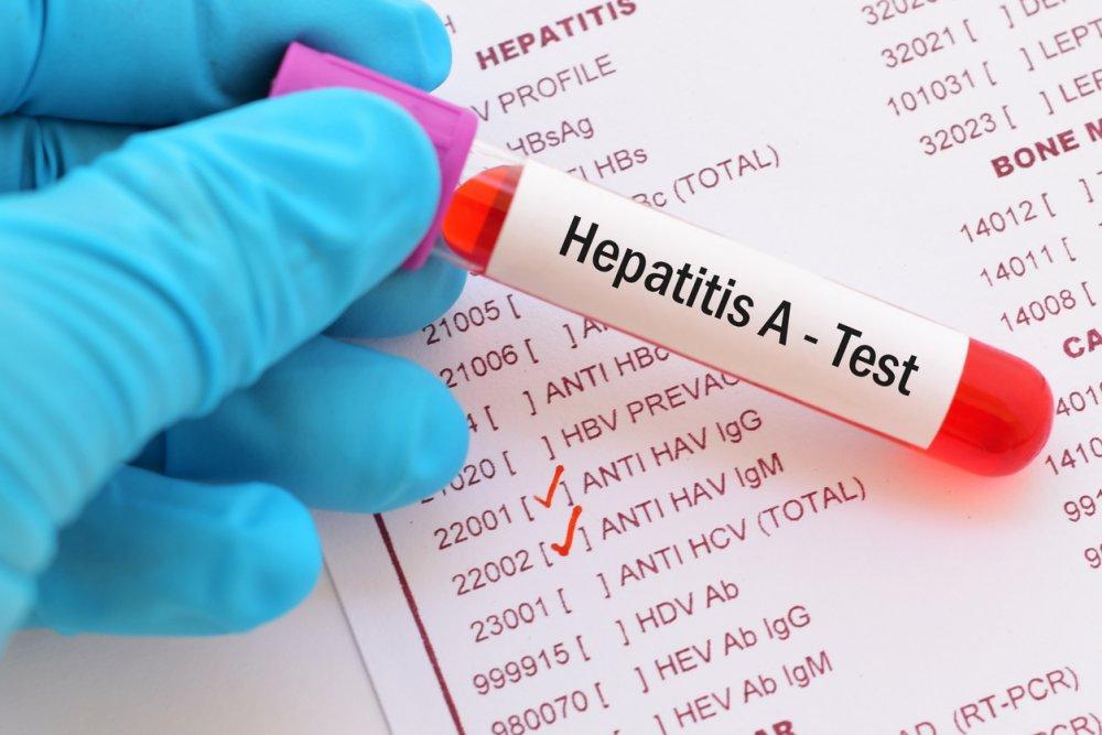 \"Hepatit A” virusuna qarşı necə mübarizə aparılmalıdır? – İnfeksionistdən AÇIQLAMA \"Hepatit A” virusuna qarşı necə mübarizə aparılmalıdır? – İnfeksionistdən AÇIQLAMA