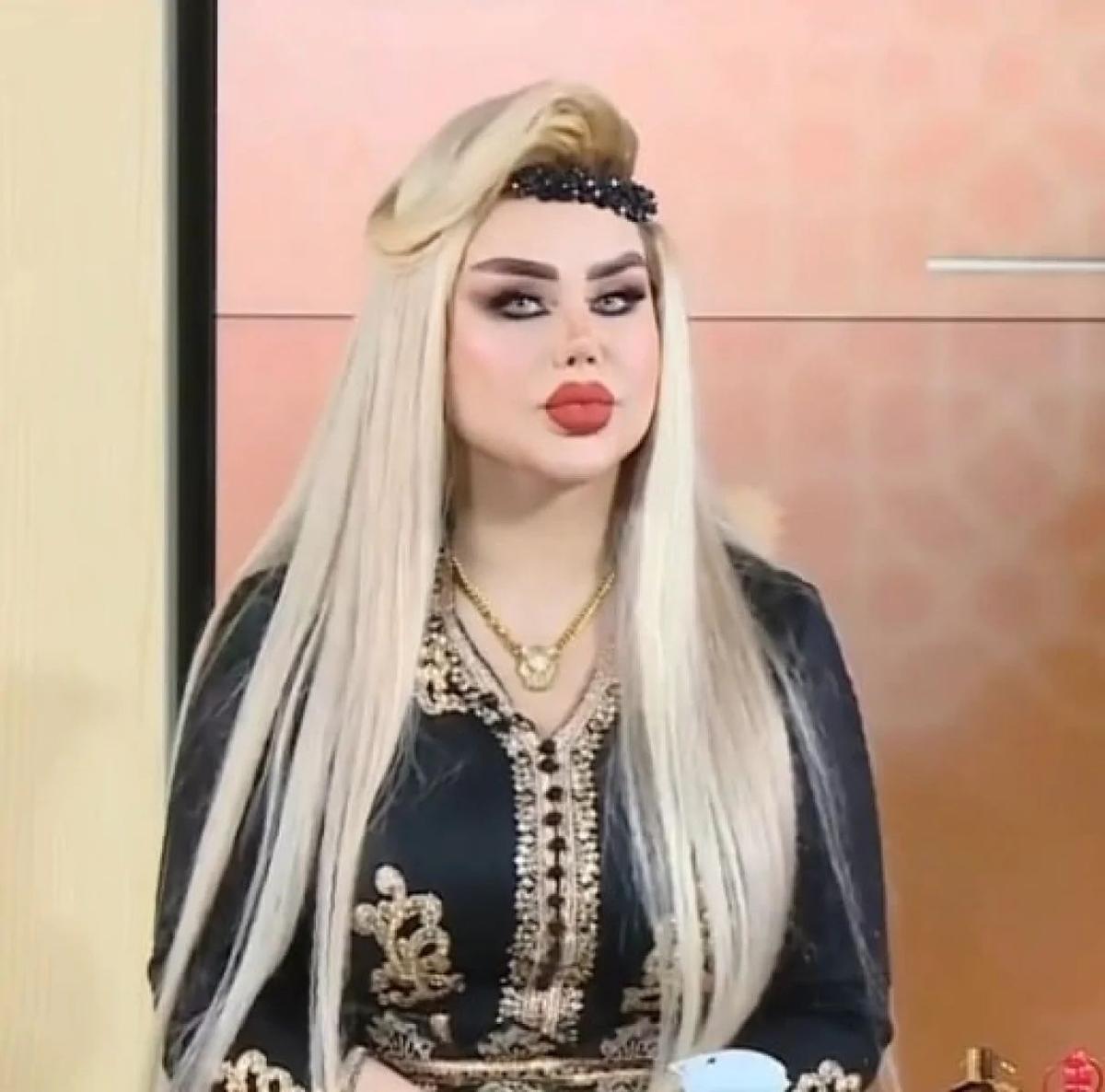 “Barbi”yə oxşamaq üçün 43 plastik əməliyyat etdirdi - FOTOLAR