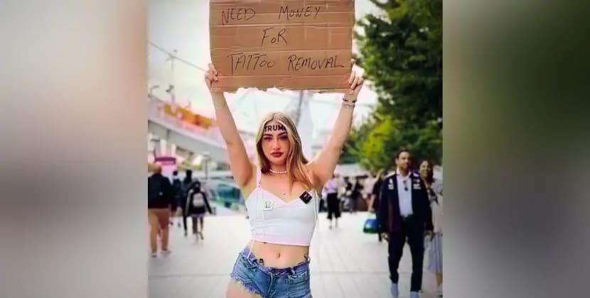 Alnında TRAMP döyməsi olan qız onu silmək üçün pul yığır - FOTOLAR