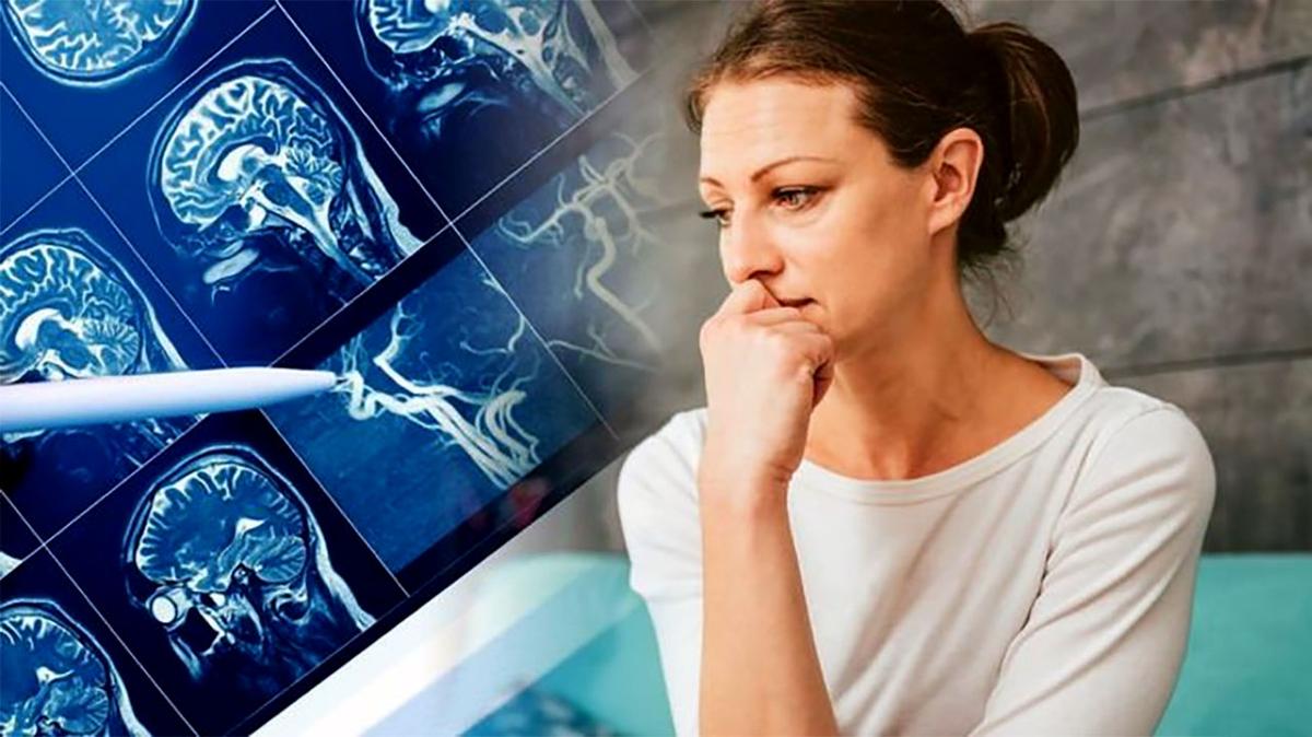 Alimlər açıqladı: Alzheimeri bu test vasitəsilə aşkarlamaq olacaq..