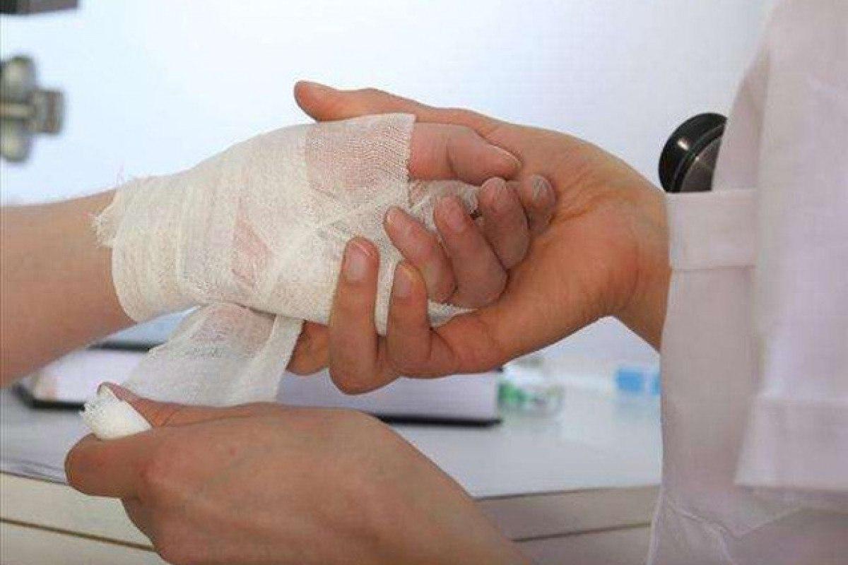 Gəncədə qadın özünə xəsarət yetirdi