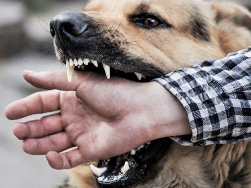 Azərbaycanda hər ay yüzlərlə insanı it dişləyir - Rəsmi
