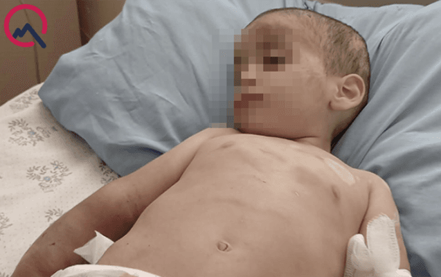 Döyülən azyaşlılardan birinin vəziyyəti ağırdır