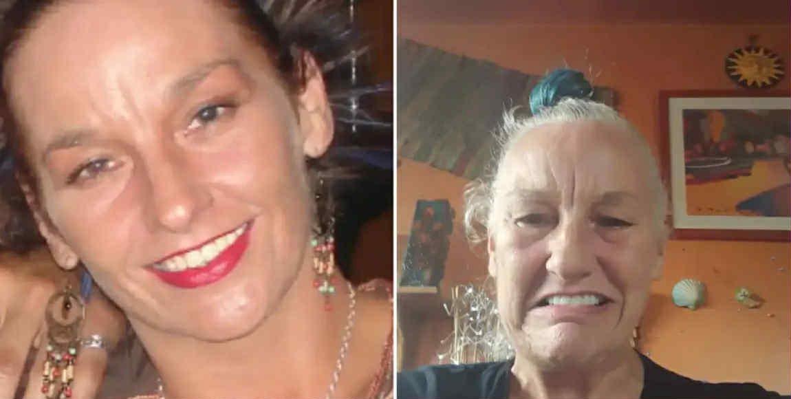 Cavanlaşmaq üçün bütün pulunu yeni dişlərə xərcləyən qadın indi 20 yaş qoca görünür - Fotolar