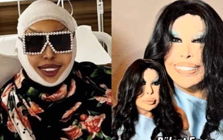 Diva estetik prosedurlarla bağlı ilk dəfə danışdı Diva estetik prosedurlarla bağlı ilk dəfə danışdı