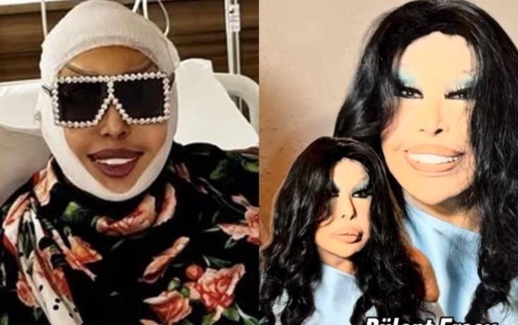 Diva estetik prosedurlarla bağlı ilk dəfə danışdı Diva estetik prosedurlarla bağlı ilk dəfə danışdı