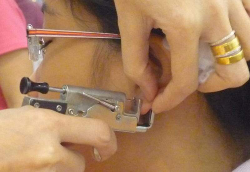 Qulağınızı deşdirməzdən əvvəl bunları bilməlisiniz – İnfeksiya və çapıq riski Qulağınızı deşdirməzdən əvvəl bunları bilməlisiniz – İnfeksiya və çapıq riski