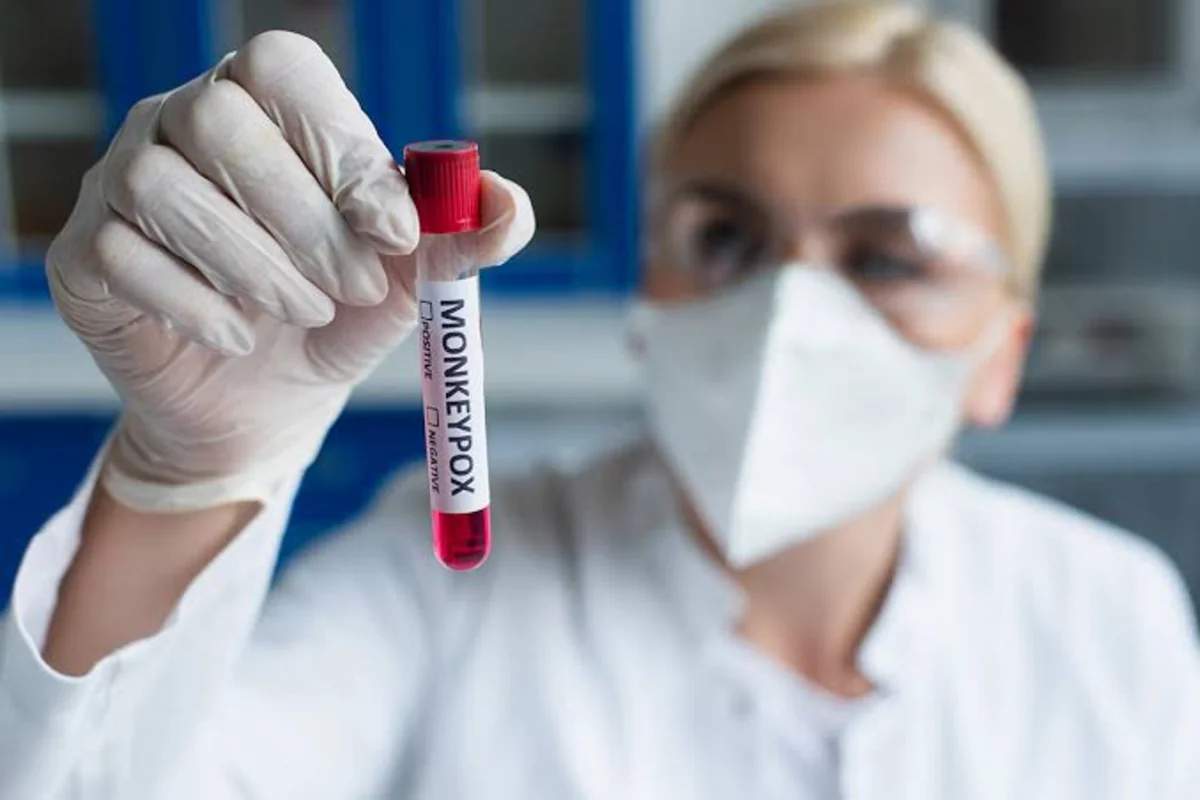 Honkonqda meymunçiçəyi sürətlə yayılır Honkonqda meymunçiçəyi sürətlə yayılır