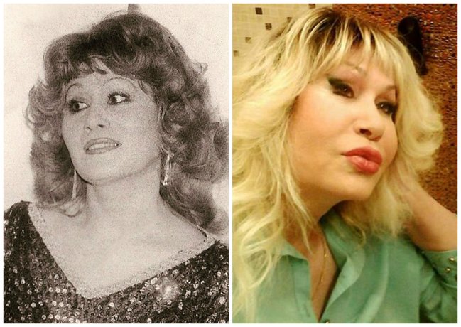 Dodaqlarını böyüdən məşhurlar - FOTOLAR