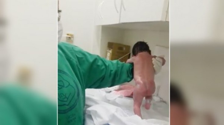 Körpə doğuşdan dərhal sonra yeriməyə başladı - Dünya bu görüntülərdən danışır...