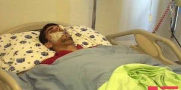 Ermənilərin yaraladığı Ağcabədi sakininin bədənindən qəlpəni götürmək mümkün olmayıb