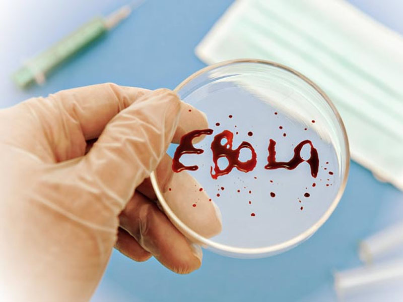 Konqoda Ebola dərdi böyüyür - 28 nəfər yoluxdu