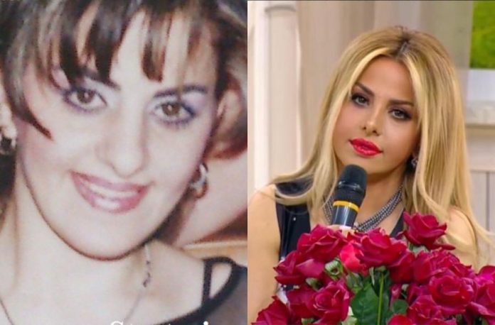 Sərxan Mətanətin estetik əməliyyatdan əvvəlki fotosunu yaydı… – FOTO