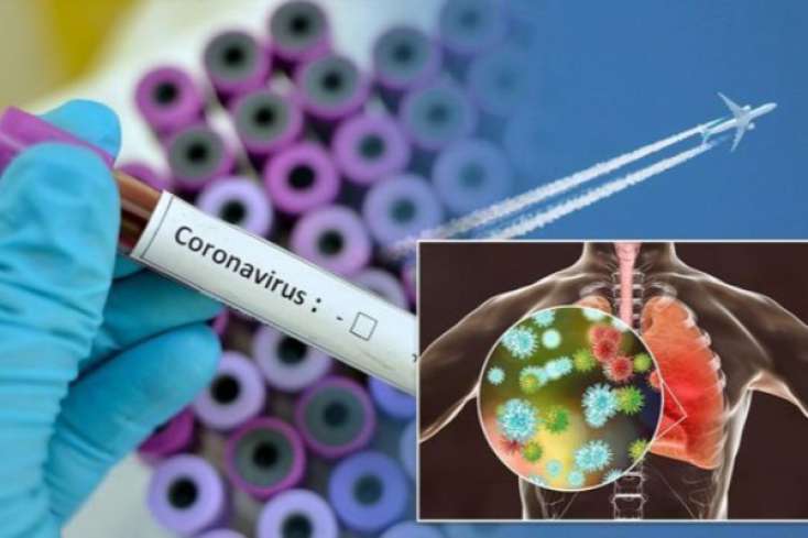 Şad Xəbər: Çin koronavirusa qarşı dərman vasitəsi tapdı