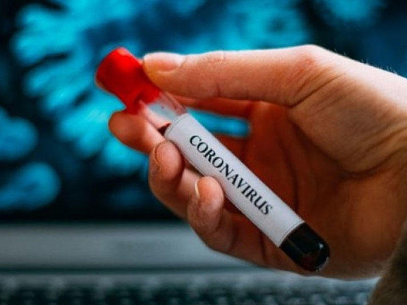Koronavirusun yeni simptomları tapıldı - Sizi çaşdıra bilər